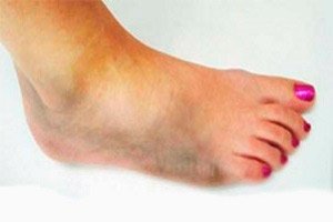 γρήγορα εξασθενημένα πόδια elena gheorghiu αδύναμη θεραπεία