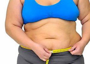 Τα νοσηρά παχύσαρκα άτομα πρέπει να χάσουν βάρος γρήγορα