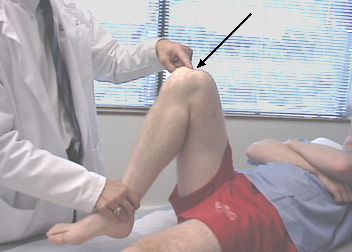 Ο πόνος στο γόνατο κατά τη διάρκεια της κάμψης είναι ο συνηθέστερος λόγος για τον οποίο οι άνθρωποι επισκέπτονται τους γιατρούς τραυμάτων. 