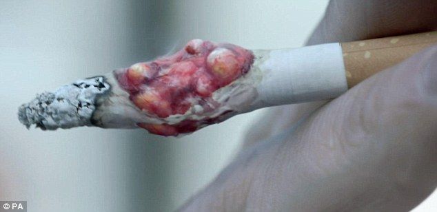 Στο Ηνωμένο Βασίλειο ξεκίνησε ένα τρομερό αντι-διαφημιστικό τσιγάρο